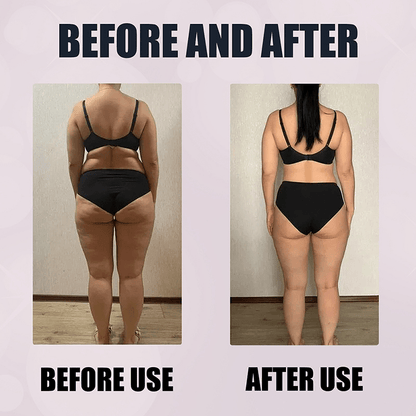 Slim Patch - Adhésif Amincissant 100% Naturel