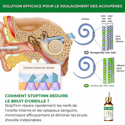 StopTinn™️ - Gouttes Pour La Surdité Et Les Maux D'oreille👂